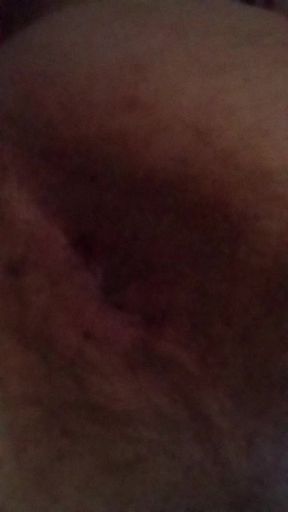 Pulse Ass