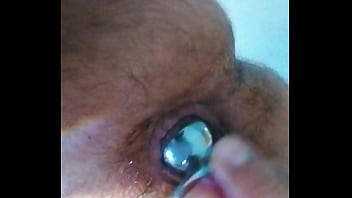 Come&ccedil_ando os trabalhos de dilata&ccedil_&atilde_o