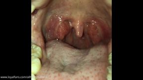 YAWNING UVULA