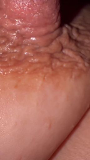 Nipple Montage