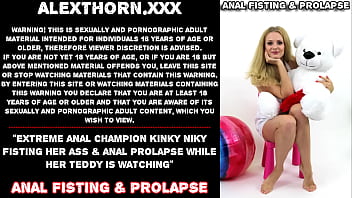 Extreme anal champion Kinky Niky fisting her ass &amp_ anal prolapse while her teddy is watching