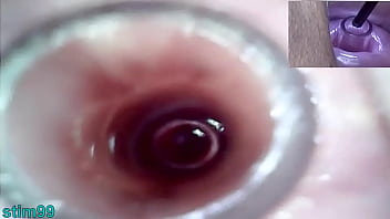 Extreme lesbian cervix play and pee hole fucking