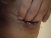 Anus dilatation