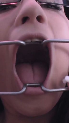 Teen mit Maulsperre weil Sie immer laut Schreit   Clip 3