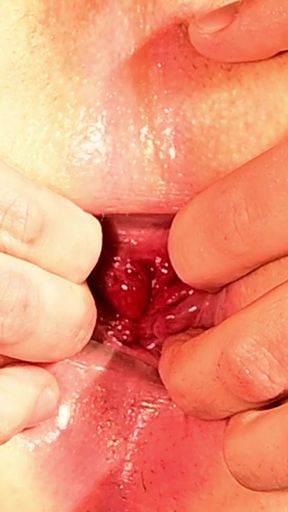 Cuckold Anal Training x extrem closeup