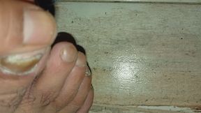 My feet and my nails are super awful