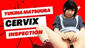 The Cervix Examination of Yukina MATSUURA