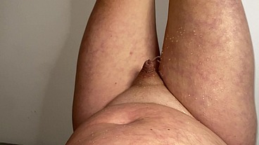 Too much foreskin and not enough cock to pee properly