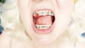 braces fetish: close up video mukbang .