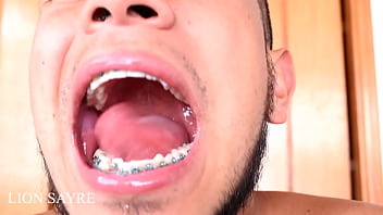 Braces Porno - Braces Porn â€“ Gay Male Tube