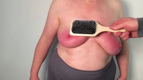 Turning your breasts painfully red until they are swollen 4-6
