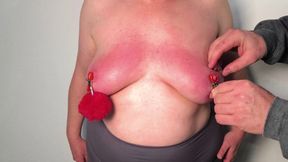 Turning your breasts painfully red until they are swollen 4-6