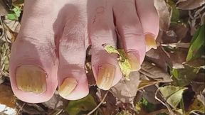 Gnarlie Harper Male Worker Feet Outdoors with Deformed Thick Yellow Toenails
