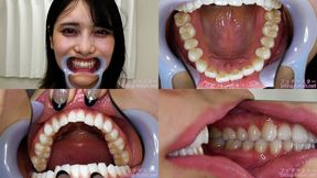 Mikana Mii - Watching Inside mouth of Japanese cute girl - MOV 1080p