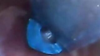 Endo-POV - Point of View: Bizarre Experiment with Small Penis Syringe & Microscope Camera in Asshole!