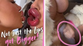 Plastic Surgery addicted Bimbos got not just their Lips done