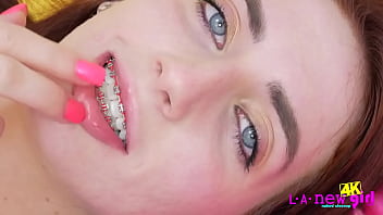 Beautiful 4K video of Teen with Braces