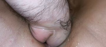 Vaginal fistin