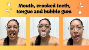 LOOK AT MY MOUTH, CROOKED TEETH, TONGUE AND BUBBLE GUM