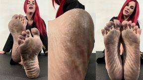 Big Dirty Karate Feet