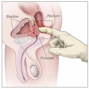 Diagram Of Hemorrhoids Beautiful Human Anus Anatomy Diagram