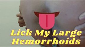 Lick My Large Hemorrhoids!!