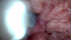 Endoscope Camera Shows the Most Sensitive Parts of the Penis Educational Video