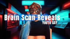 Brain Scan Reveals Youre GAY