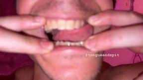 Logan Teeth Part17 Video1 - MP4