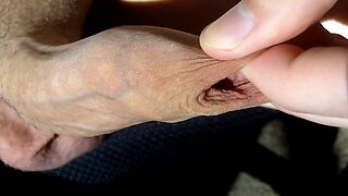 Foreskin stretching