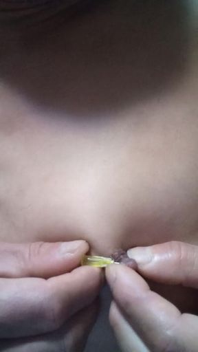 Niple needle