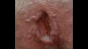 Exhibit Anal