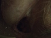 4k pee post op