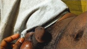 Hairy ball