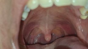 Details of my uvula.