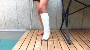 The car accident - short cast leg movie