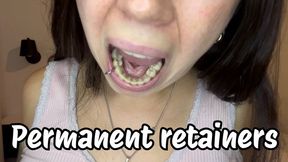 Show you my permanent retainers