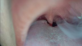 Smoky Mouth & Uvula Views