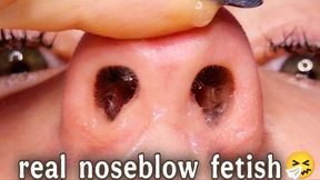 Real Noseblow Fetish – Messy & Close-Up 4K