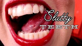 Slutty Teeth