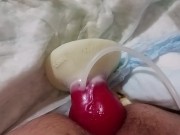 Knotting paraplegic ass