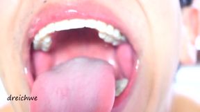 Delicious Wide Open Mouth With Lots Of Saliva