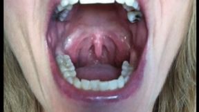 PLAYFUL UVULA