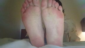 FEET FIXATION