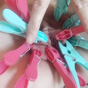 Clamping inner and outer labia