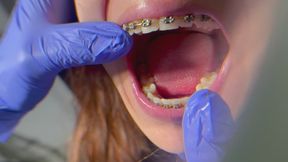 Doctor analyzes my braces and mouth