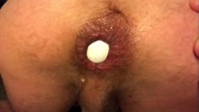 Insertion anal   doigt