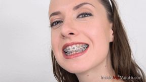 Inside My Mouth - Jennifer - Dental braces clip! (FULLHD quality)