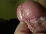 Closeup glans
